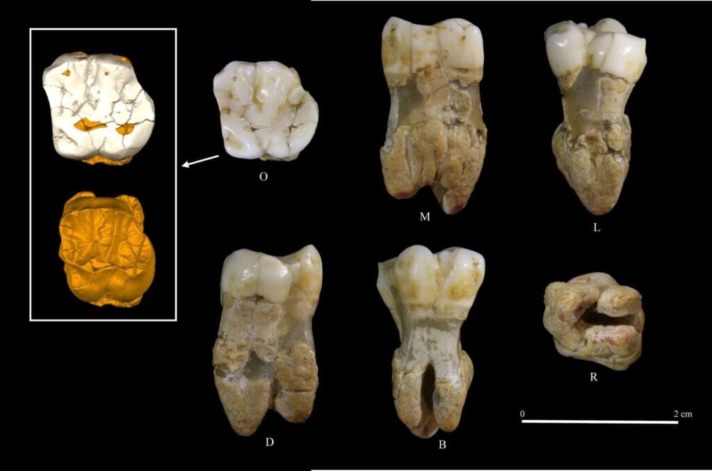 Dente Camerota
