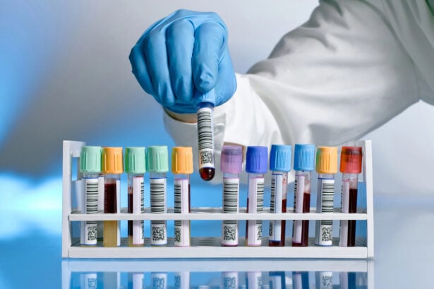 Laboratorio analisi
