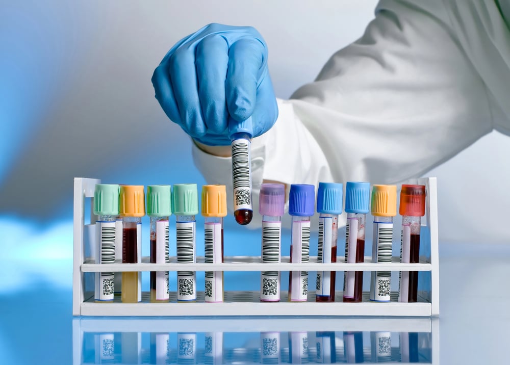 Laboratorio analisi