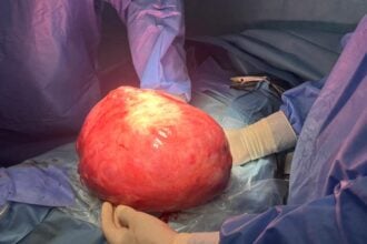 Tumore 10 kg