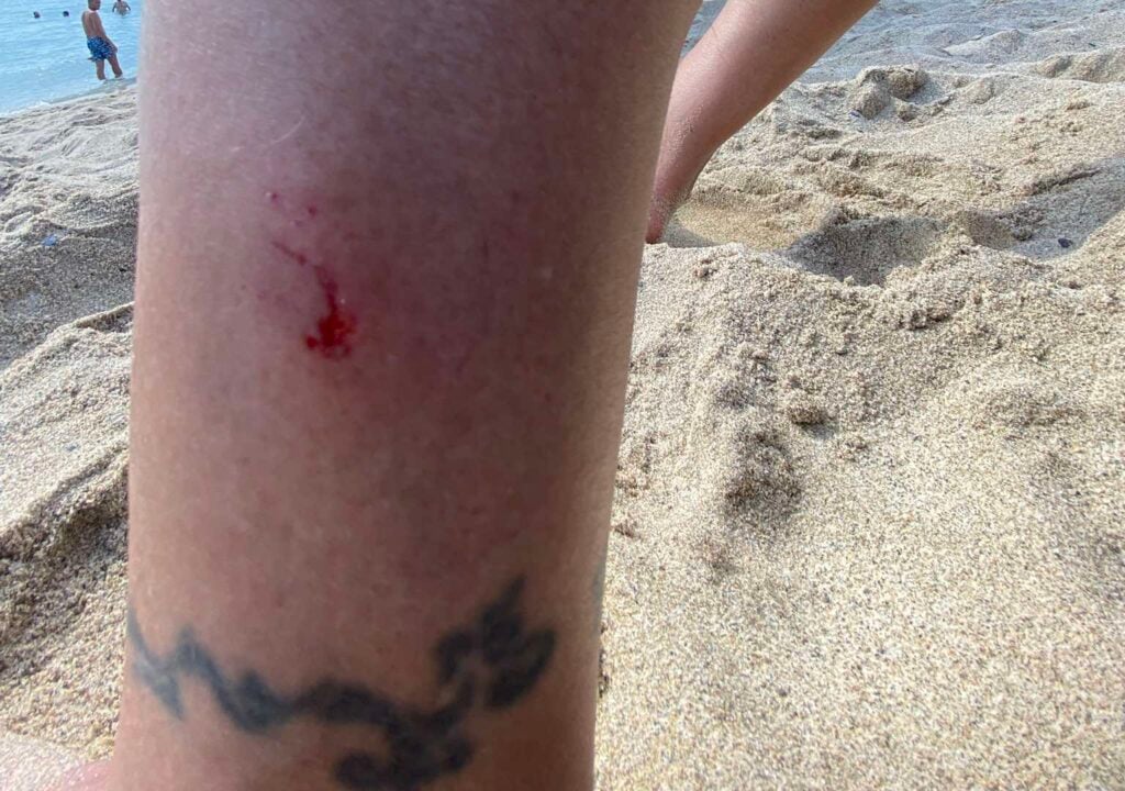 Cilento, nuovi avvistamenti in mare: lievi morsi e l’ipotesi del trigone viola