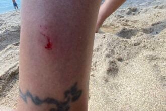 Cilento, nuovi avvistamenti in mare: lievi morsi e l’ipotesi del trigone viola
