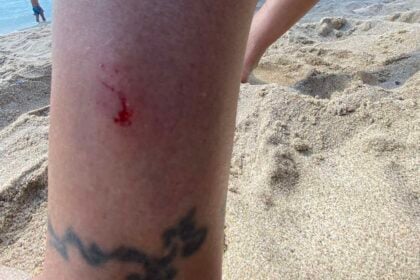 Cilento, nuovi avvistamenti in mare: lievi morsi e l’ipotesi del trigone viola